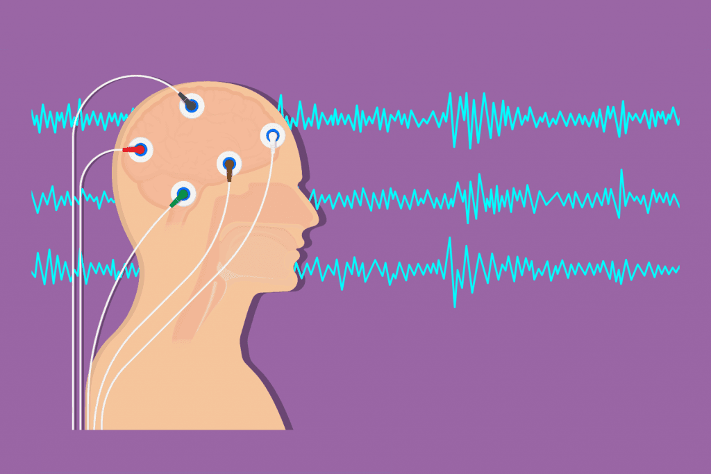 Grafische Illustration eines Kopfes mit Elektroden und Kabeln, daneben verlaufende Linien, die Gehirnwellen darstellen